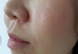 Enlarged pores are a sign of oily skin.